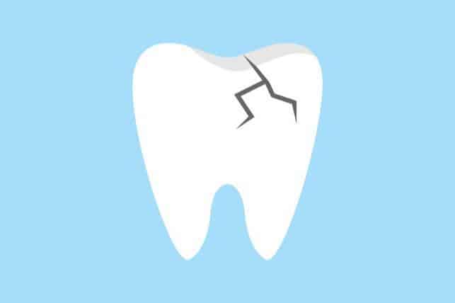 what are dental sealants and how do they help teeth 63a31fcc0c1b5