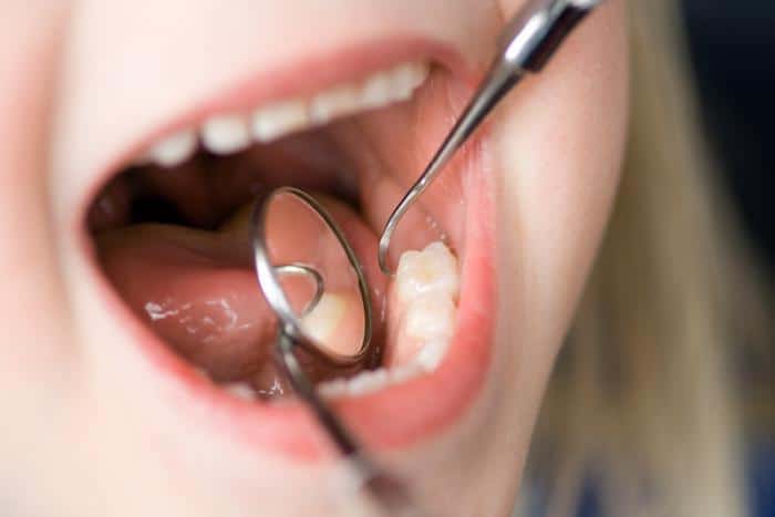 5 Signs of a Dental Emergency