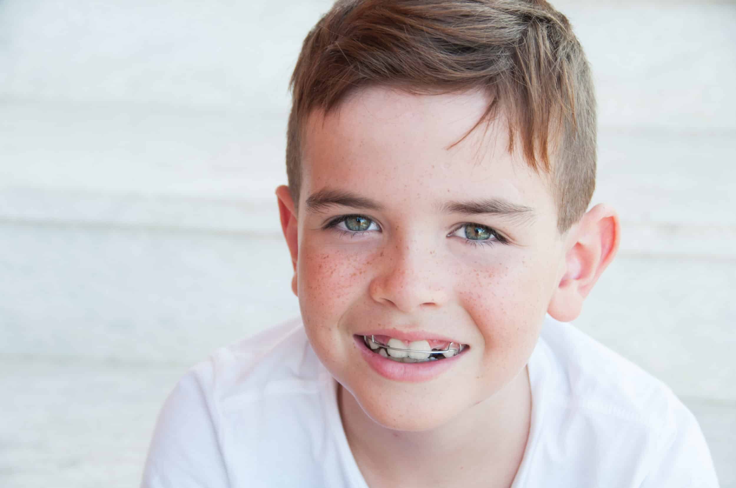 Child after orthodontic treatment in Ontario, CA